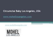 Circumcise Baby Los Angeles, USA - www.mohellosangeles.com