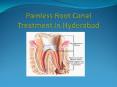 Painless Root Canal Treatment in Hyderabad PowerPoint PPT Presentation
