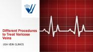 Varicose Veins Treatment Procedures - USA Vein Clinics