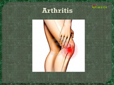 Arthritis: Symptoms, causes, diagnosis, treatment and prevention