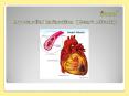 Myocardial Infarction (Heart Attack): Symptoms, Causes, Risk Factors, Diagnosis, and Treatment PowerPoint PPT Presentation