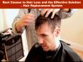 Root Causes to Hair Loss and the Effective Solution – Hair Replacement System PowerPoint PPT Presentation