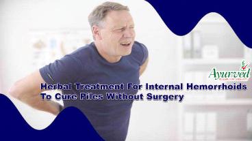 Herbal Treatment For Internal Hemorrhoids To Cure Piles Without Surgery