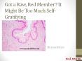 Got a Raw, Red Member? It Might Be Too Much Self-Gratifying PowerPoint PPT Presentation