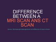 The Difference Between a MRI Scan and CT Scan
