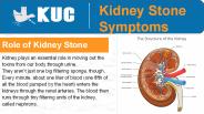 Impact of Kidney Stones on One’s Health