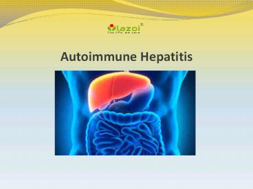 Autoimmune Hepatitis: Symptoms, causes and treatment