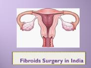 Fibroids Surgery in India