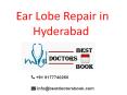 Ear Lobe Repair in Hyderabad | Ear Lobe Surgery in Hyderabad PowerPoint PPT Presentation