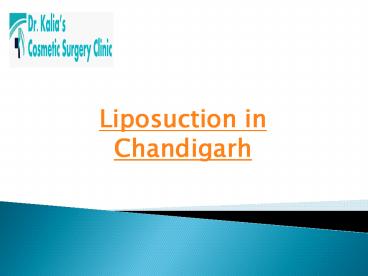 Liposuction in Chandigarh (3)