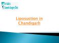 Liposuction in Chandigarh (3) PowerPoint PPT Presentation