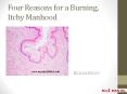 Four Reasons for a Burning, Itchy Manhood PowerPoint PPT Presentation