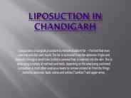 Best Liposuction in Chandigarh