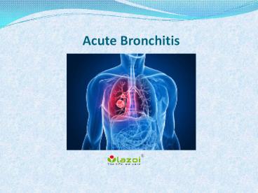 Acute bronchitis: Causes, symptoms and treatment