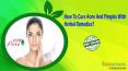 How To Cure Acne And Pimples With Herbal Remedies?
