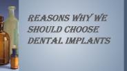Reasons Why We Should Choose Dental Implants