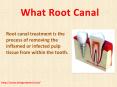 Dentist Lithia: Best Root Canal Treatment With Dr. Laura Bridges PowerPoint PPT Presentation