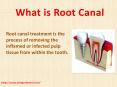 Dentist Lithia: Best Root Canal Treatment With Dr. Laura Bridges (1) PowerPoint PPT Presentation