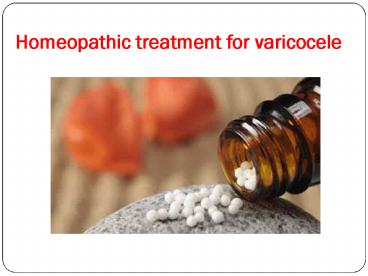 Homeopathic treatment for varicocele 1 aug 17