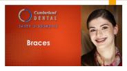 Braces