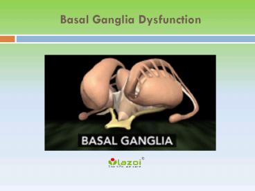 Basal ganglia dysfunction: What you need to know