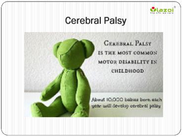 Cerebral Palsy: Symptoms, causes, diagnosis and treatment