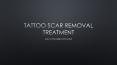 Tattoo Scar Removal Treatment what you need to know PowerPoint PPT Presentation