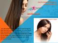 Effective Changing Hair Loss Treatment in Delhi PowerPoint PPT Presentation