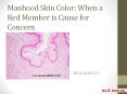 Manhood Skin Color: When a Red Member is Cause for Concern PowerPoint PPT Presentation