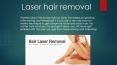 Laser hair removal treatment at SCUPT PowerPoint PPT Presentation