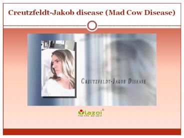Creutzfeldt-Jakob disease (Mad Cow Disease): Symptoms, causes, diagnosis and treatment