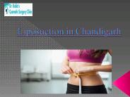 Best Liposuction in Chandigarh (1)