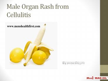 Male Organ Rash from Cellulitis
