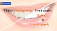 Best Dentists In Chandigarh - Specialists Dental Care PowerPoint PPT Presentation