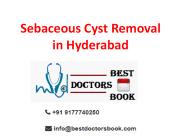Sebaceous Cyst Removal in Hyderabad