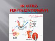 IVF INTIAL APPROCH 11 aug 17