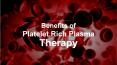Benefits of Platelet Rich Plasma Therapy PowerPoint PPT Presentation