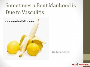 Sometimes a Bent Manhood is Due to Vasculitis