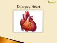 Enlarged Heart (Cardiomegaly): Symptoms, causes, diagnosis and treatment