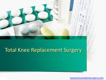 PPT on Total knee Replacement Surgery