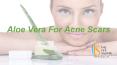 Aloe Vera For Acne Scars PowerPoint PPT Presentation
