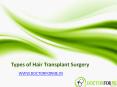 Types of Hair Transplant Surgery PowerPoint PPT Presentation
