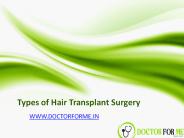 Types of Hair Transplant Surgery