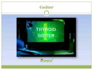 Goiter: Read about symptoms, causes and treatment