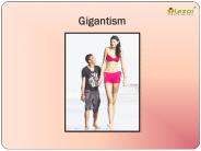 Gigantism: Definition, Causes, Symptoms and treatment