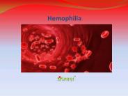 Hemophilia: Symptoms, Causes, and Treatment