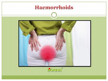 Haemorrhoids: Symptoms, causes, diagnosis and treatment