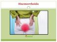 Haemorrhoids: Symptoms, causes, diagnosis and treatment PowerPoint PPT Presentation