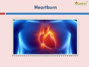 Heartburn: Symptoms, Causes and Treatment