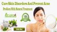 Cure Skin Disorders And Prevent Acne Problem With Natural Treatment PowerPoint PPT Presentation